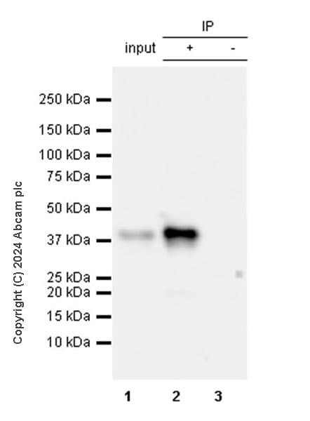 Cholera Enterotoxin Subunit B Antibody Epr27372 4 Ab317738  Immunoprecipitation Img432140