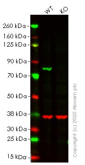 Anti-Calnexin antibody [EPR3633(2)] - ER Membrane Marker(AB133615)