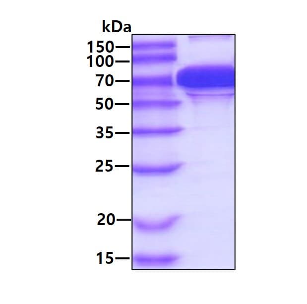 Ab79145  Sds Page Img185962