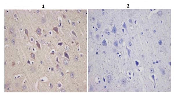 Anti-Tyrosine Hydroxylase antibody - Neuronal Marker(AB112)
