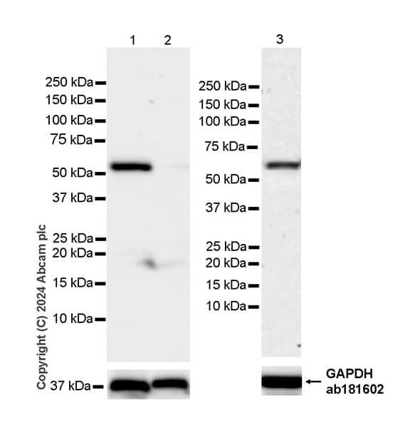 Anti-ST2 antibody [EPR28307-82](AB317557)