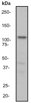 Anti-Androgen Receptor antibody [EP670Y](AB52615)