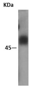 Anti-CXCR4 antibody [EPUMBR3](AB181020)
