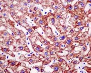 Nadk2 Antibody Epr13170 Ab181028  Immunohistochemistry Formalin Pfa Fixed Paraffin Embedded Sections Img136037