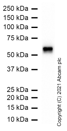 Anti-Nicotinic Acetylcholine Receptor beta/CHRNB1 antibody [EP2067Y](AB76159)