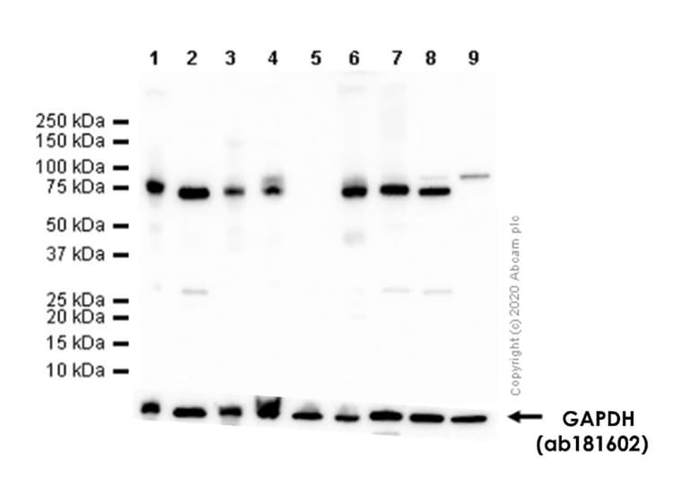 Anti-METTL3 antibody [EPR18810](AB195352)