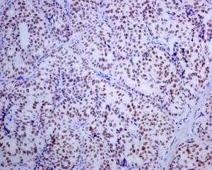 Anti-Islet 1 antibody [EPR10362](AB178400)