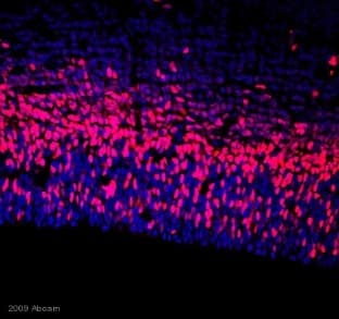Anti-TBR2 / Eomes antibody(AB23345)