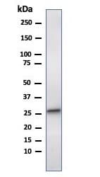 Hsp27 Antibody Cptc Hspb1 2 Ab268073  Western Blot Img36637