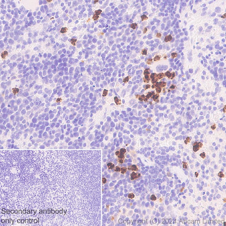 Ykl 40 Chi3l1 Antibody Rm1204 Bsa And Azide Free Ab319165  Immunohistochemistry Formalin Pfa Fixed Paraffin Embedded Sections Img434079