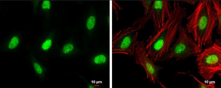 Anti-ZEB1 antibody(AB155249)