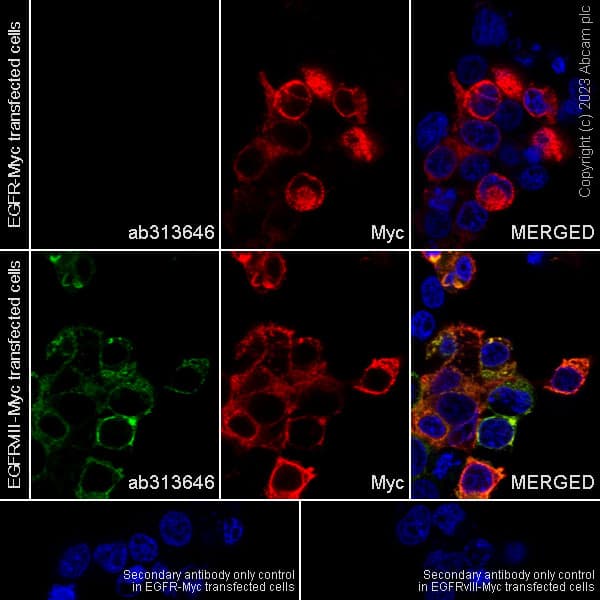 Egfrviii Antibody Epr28380 83 Bsa And Azide Free Ab313647  Immunocytochemistry Immunofluorescence Img418489
