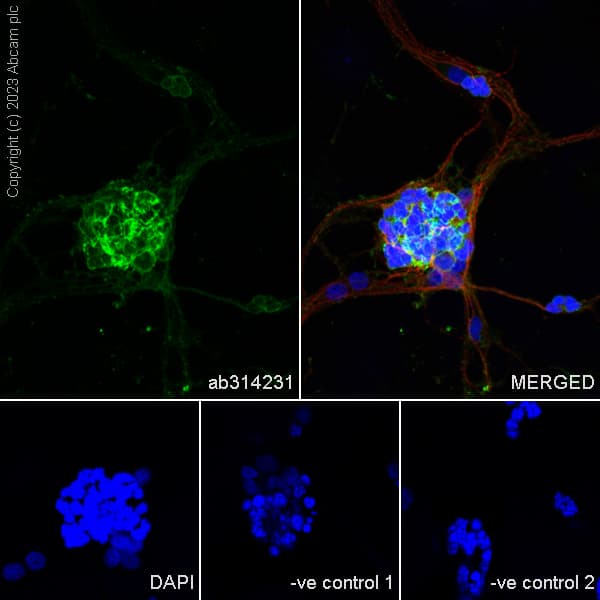 Anti-RS1 antibody [EPR28513-78](AB314231)