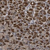 Dnajc14 Antibody Ab121535  Immunohistochemistry Formalin Pfa Fixed Paraffin Embedded Sections Img99696