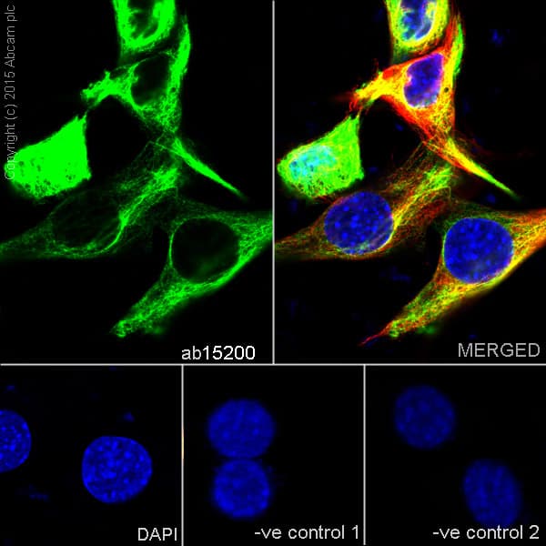 Anti-Desmin antibody - Cytoskeleton Marker(AB15200)