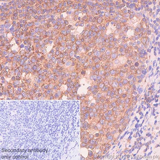 Vpac2 Antibody Sp235 Bsa And Azide Free Ab246352  Immunohistochemistry Formalin Pfa Fixed Paraffin Embedded Sections Img28201