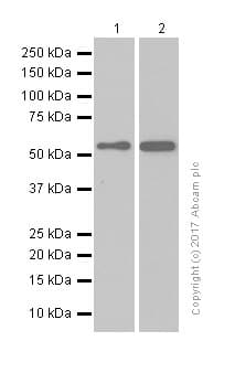 Anti-Retinoic Acid Receptor beta antibody [EPR2017](AB124701)