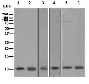 Anti-S100 alpha antibody [EPR5251](AB109384)