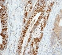 Anti-Trefoil Factor 3 antibody [EPR3974](AB108599)