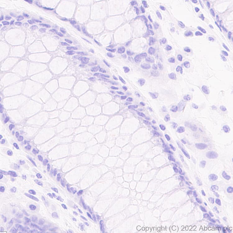 Anti-Strep-tag II antibody [EPR28119-43](AB307676)