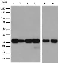 Qdpr Dhpr Antibody Ep12595 Ab186411  Western Blot Img115183