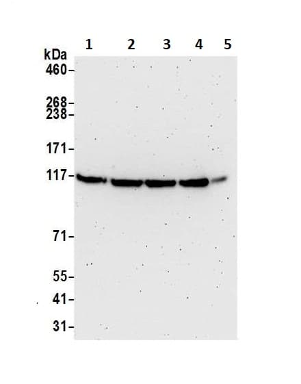 Mtr4 Antibody Ab70551  Western Blot Img82712