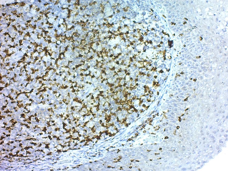 Rabbit specific HRP/DAB Detection IHC Detection Kit - Micro-polymer(AB236469)
