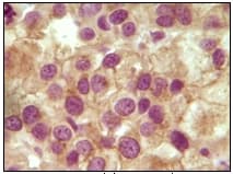 Anti-Inhibin alpha antibody [4A2F2](AB47720)