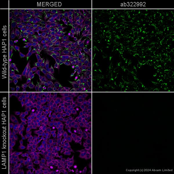 Alexa Fluor 594 Alpha Tubulin Antibody Ep1332y Microtubule Marker Ab202272  Immunocytochemistry Immunofluorescence Img440911