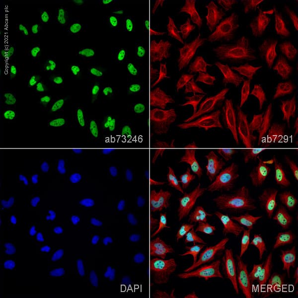 Prmt1 Antibody Ab73246  Immunocytochemistry Img165954