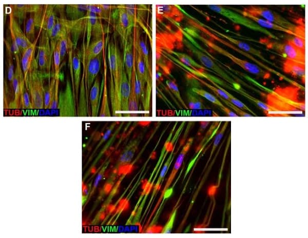 Anti-Tubulin antibody [YL1/2] - Loading Control(AB6160)