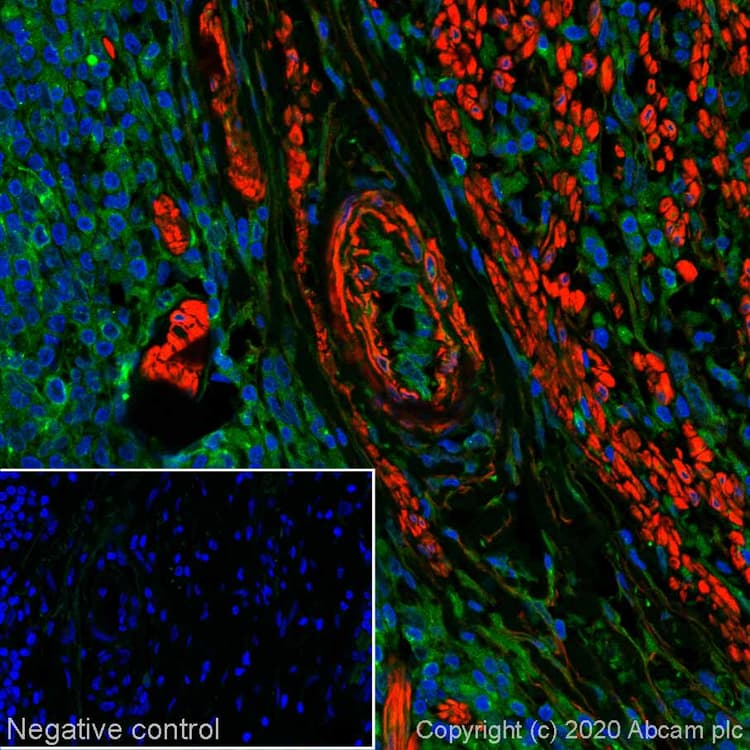 Alexa Fluor 647 Alpha Smooth Muscle Actin Antibody Sp171 Ab267537  Immunohistochemistry Formalin Pfa Fixed Paraffin Embedded Sections Img24397