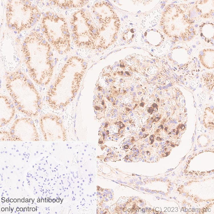 Limpii Antibody Epr26243 125 Ab314217  Immunohistochemistry Formalin Pfa Fixed Paraffin Embedded Sections Img421584