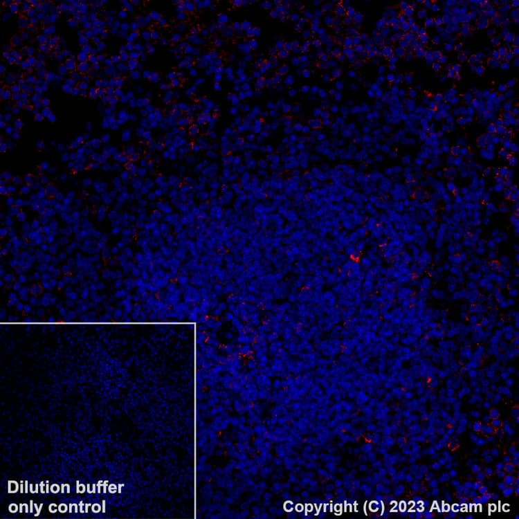 Alexa Fluor 647 Mthfd2 Antibody Epr26938 20 Ab314930  Immunohistochemistry Formalin Pfa Fixed Paraffin Embedded Sections Img422268