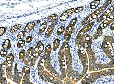 Anti-pan Cytokeratin antibody [AE1/AE3 + 5D3](AB86734)