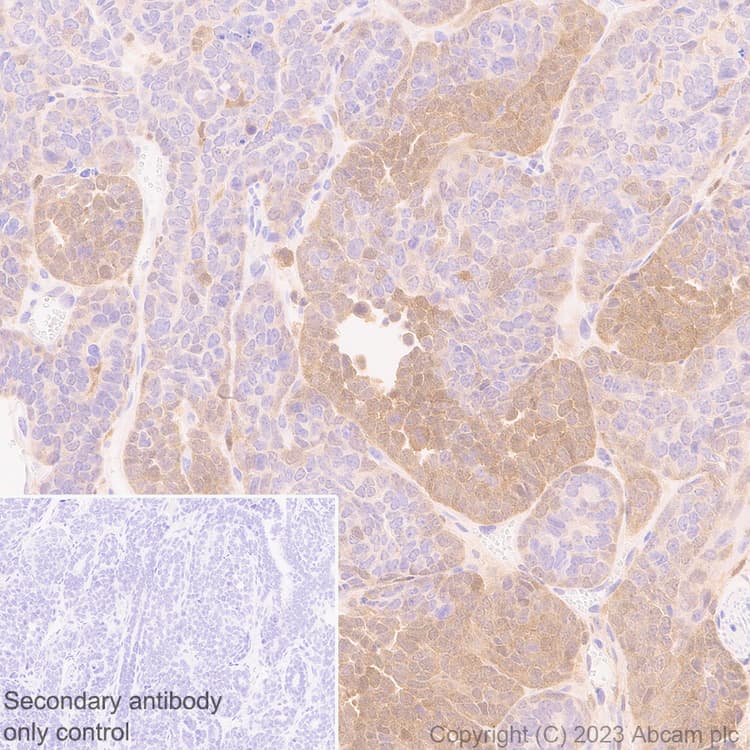 Anti-TMS1/ASC antibody [RM1049](AB309497)