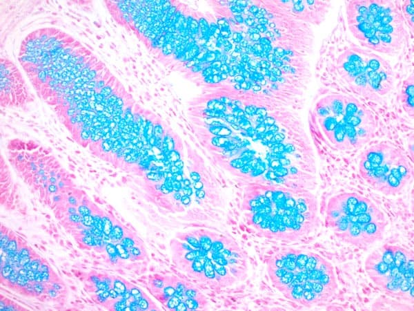 Alcian Blue Stain Kit (pH 2.5, Mucin Stain)(AB150662)