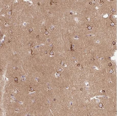 Msmp Antibody Ab185471  Immunohistochemistry Formalin Pfa Fixed Paraffin Embedded Sections Img124518