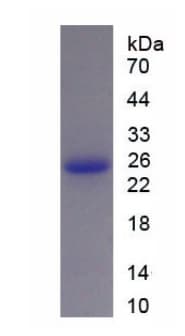 Recombinant Cow Growth Hormone protein (His tag)(ab275561)