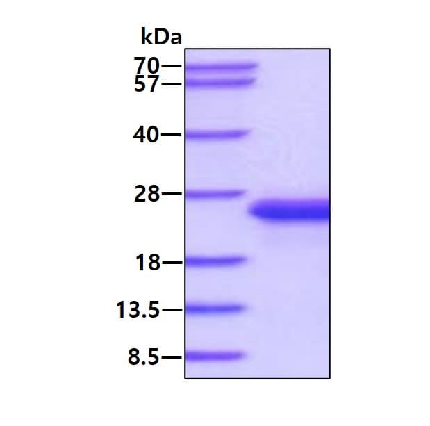 Ab187455  Sds Page Img183629