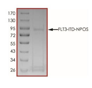 Recombinant human Flt3 / CD135 protein (L610_E611insCSSDNEYFYVDFREYEYDLKWEF-PRENL) (Active)(AB268586)