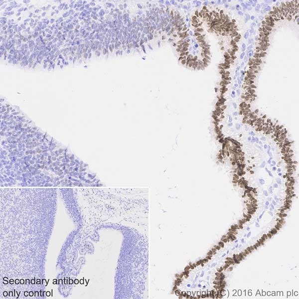 Anti-Otx2 antibody [EPR20375](AB183951)