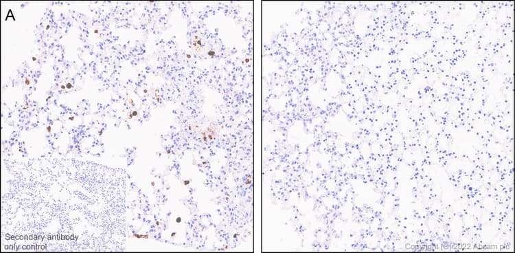Anti-TNF alpha antibody [RM1005](AB307164)