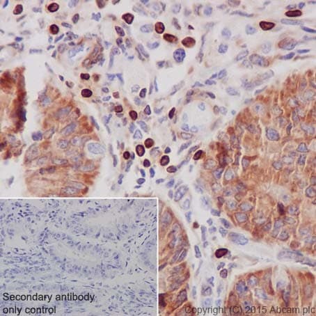 Anti-Bcl-2 antibody [EPR17509](AB182858)