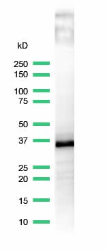 Anti-CD20 antibody [SP32](ab64088)