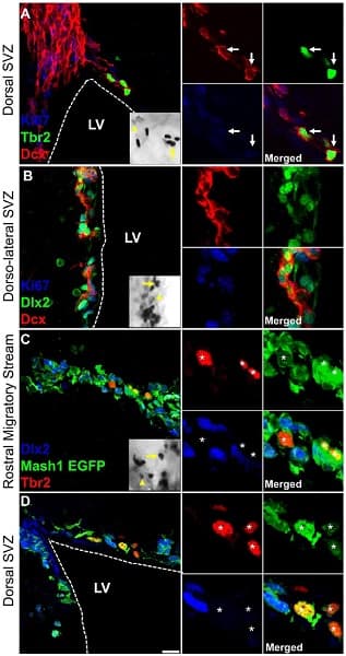 Anti-TBR2 / Eomes antibody(AB23345)