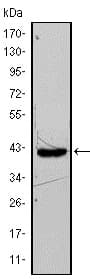 Anti-FABP4 antibody [9B8D](AB93945)