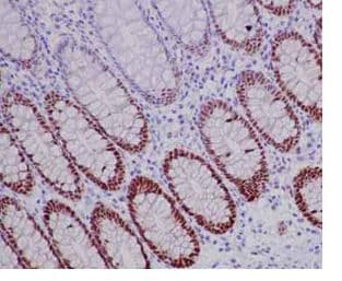Sox9 Antibody Epr14335 78 Ab185966 Immunohistochemistry Formalin Pfa Fixed Paraffin Embedded Sections Img78178