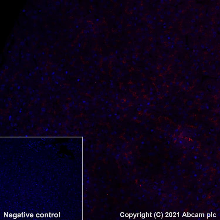 Alexa Fluor 555 Lamp2a Antibody Epr42072 Lysosome Marker Ab282009  Immunohistochemistry Formalin Pfa Fixed Paraffin Embedded Sections Img180823