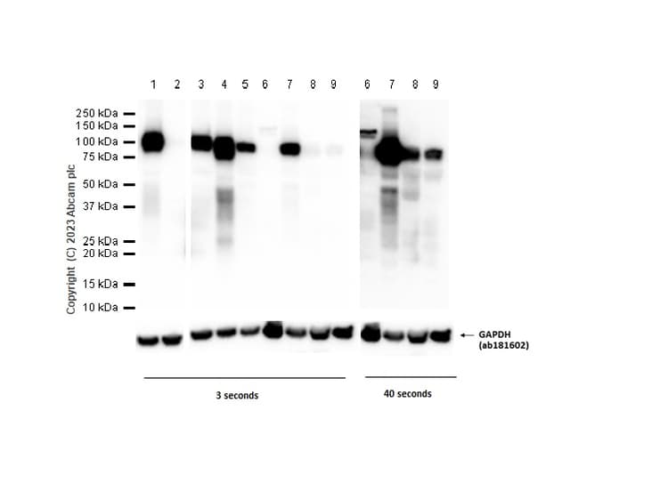 Anti-MMP9 antibody [EP1254](AB76003)